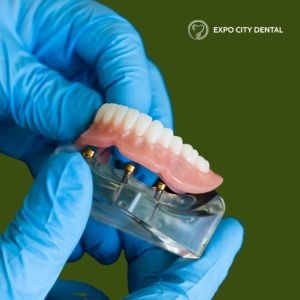 dental implant supported dentures