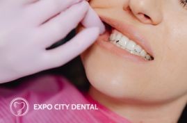 Why It's Important to Improve Your Bite with Tooth Loss 