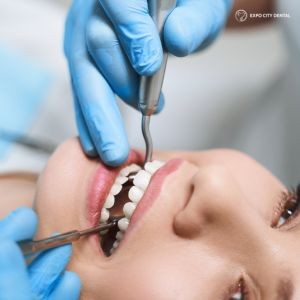 root canal treatment at dentist in Vaughan