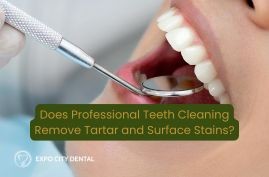 teeth cleaning at local dental office in Vaughan for tartar and plaque