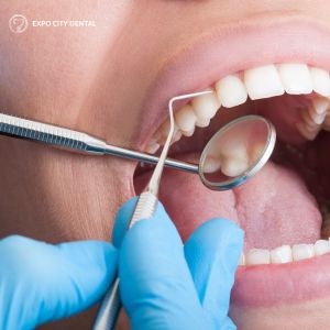 Why Professional Teeth Cleaning is Key to Preventing Gum Disease