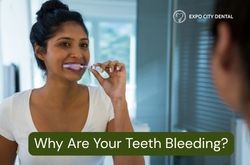 brushing teeth bleeding gums