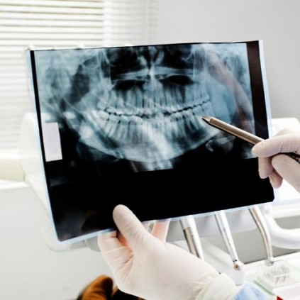 Oral Biopsies and Cancer Screenings