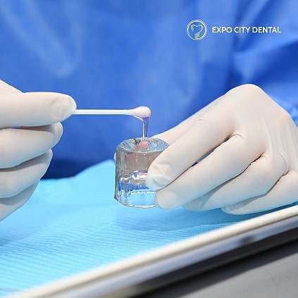 fluoride application