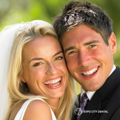 wedding zoom teeth whitening Vaughan