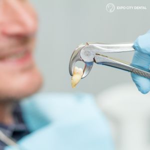 wisdom teeth removal