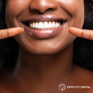 dental cleaning vaughan