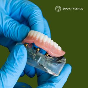 denture supported by dental implants in Vaughan