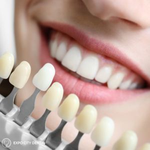 teeth whitening